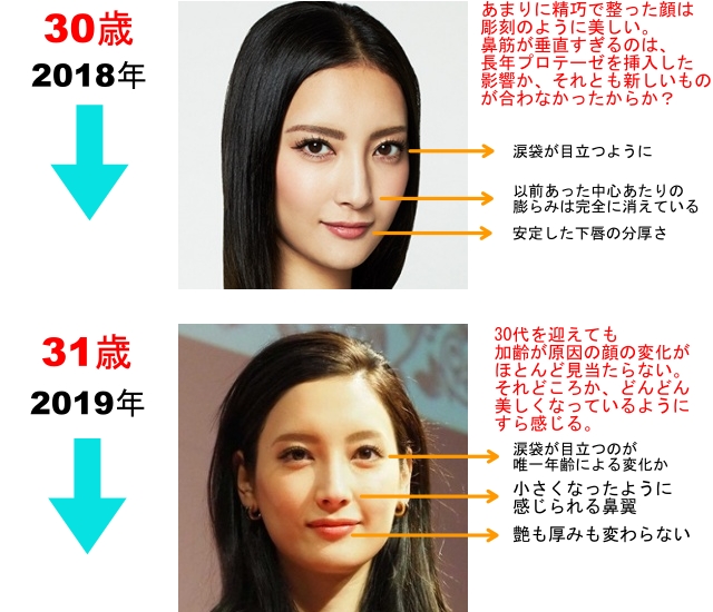2018年 30歳 あまりに精巧で整った顔は彫刻のように美しい。 鼻筋が垂直すぎるのは、長年プロテーゼを挿入した影響か、それとも新しいものが合わなかったからか？ 涙袋が目立つように。 以前あった中心あたりの膨らみは完全に消えている。 安定した下唇の分厚さ。 2019年 31歳 30代を迎えても加齢が原因の顔の変化がほとんど見当たらない。 それどころか、どんどん美しくなっているようにすら感じる。 涙袋が目立つのが唯一年齢による変化か。 小さくなったように感じられる鼻翼。 (唇)ツヤも厚みも変わらない。