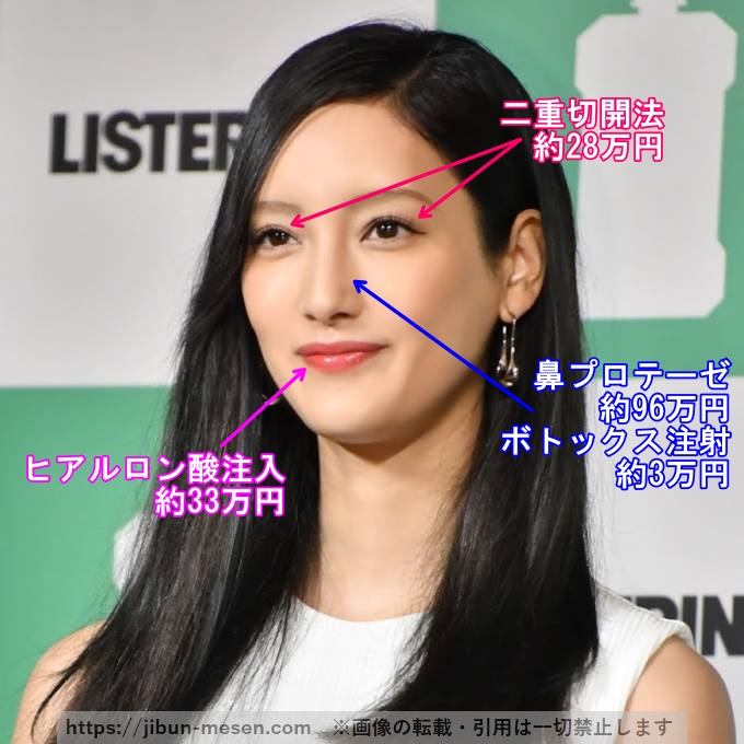 菜々緒が整形した箇所とその費用の画像