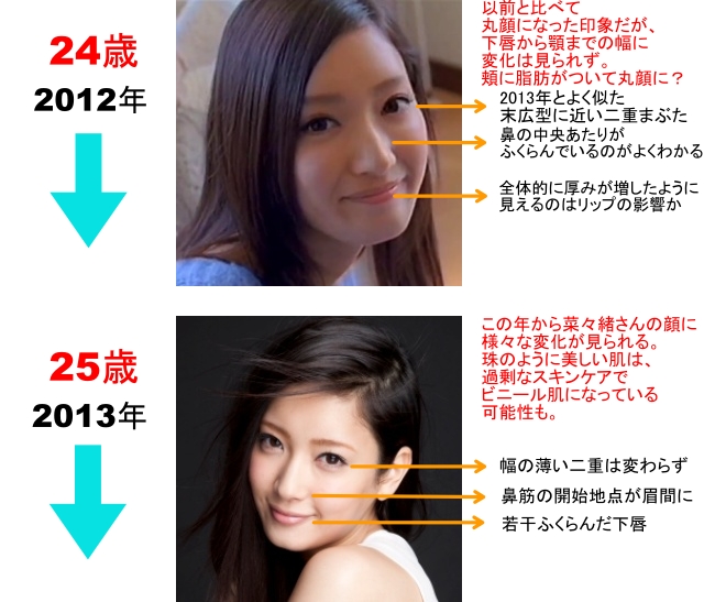 2012年 24歳 以前と比べて丸顔になった印象だが、下唇から顎までの幅に変化は見られず。 頬に脂肪がついて丸顔に？ 2013年とよく似た末広型に近い二重まぶた。 鼻の中央あたりがふくらんでいるのがよくわかる。 全体的に厚みが増したように見えるのはリップの影響か。 2013年 25歳 この年から菜々緒さんの顔に様々な変化が見られる。 珠のように美しい肌は、過剰なスキンケアでビニール肌になっている可能性も。 幅の薄い二重は変わらず。 鼻筋の開始地点が眉間に。 若干ふくらんだ下唇。