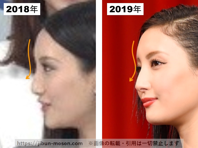 菜々緒の鼻の2018年と2019年の比較の画像