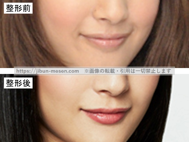 菜々緒の唇の整形前と整形後の比較の画像