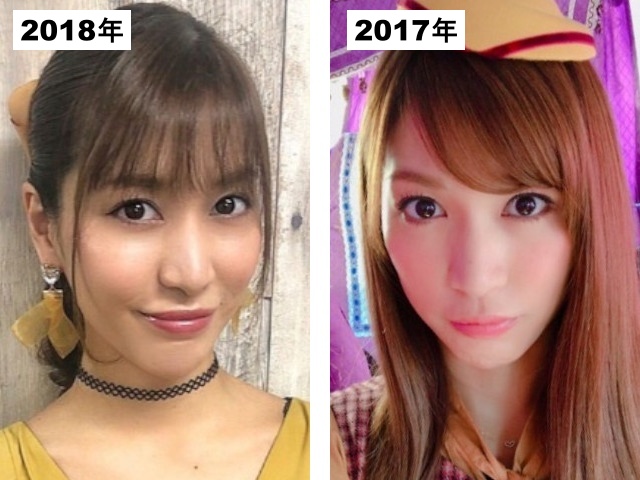 大島麻衣の頬の整形疑惑検証2017-2018の画像
