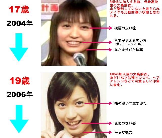2004年 17歳AKB48に加入する前、当時高校生の大島麻衣。 まだ整形していないと考えられメイクも比較的薄い状態と思われる。 横幅の広い瞳。 茎が見える笑い方(ガミースマイル)。 丸みを帯びた輪郭。 2006年 19歳 AKB48加入後の大島麻衣。 あどけなさは残りつつも、ヘアアレンジなどで可愛らしい印象に変化。 幅の薄い二重まぶた。 変化のない唇。 平らな顎先。