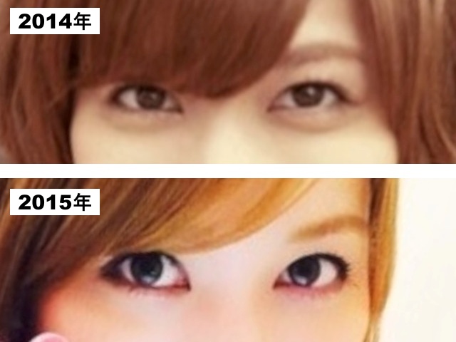 大島麻衣の目の整形検証の画像