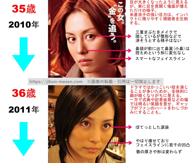米倉涼子の整形疑惑検証2010年〜2011年の画像