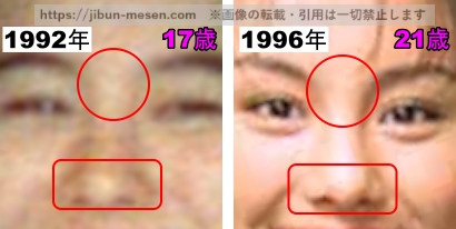 米倉涼子の鼻の整形検証1992年～1996年の画像（拡大）