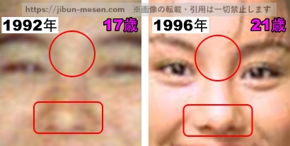 米倉涼子の鼻の整形検証1992年~1996年の画像(拡大)