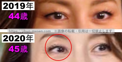 米倉涼子の目の整形検証2019年～2020年の画像（拡大）