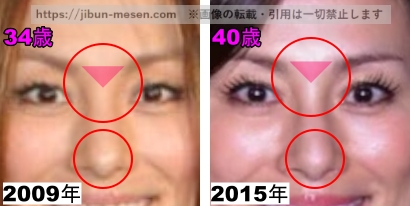 米倉涼子の鼻の整形検証2009年～2015年の画像（拡大）