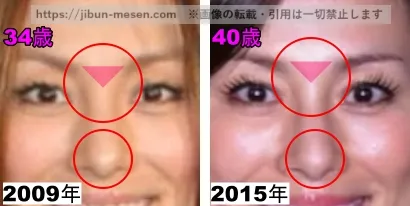 米倉涼子の鼻の整形検証2009年~2015年(拡大)