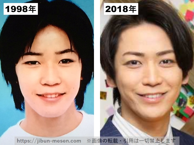 亀梨和也のフェイスラインの比較1998年〜2018年の画像