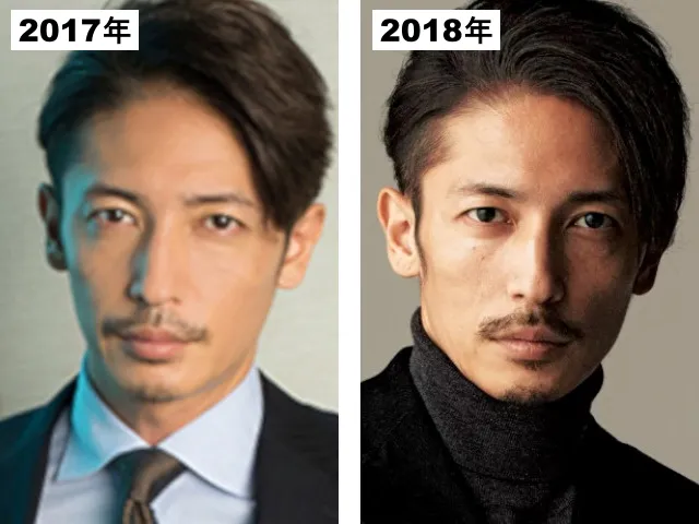 玉木宏の整形疑惑検証2017-2018
