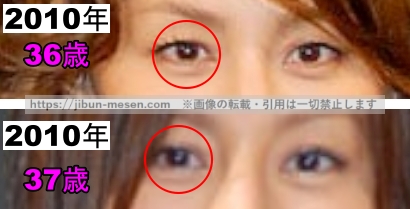 米倉涼子の目の整形検証2010年～2011年の画像（拡大）