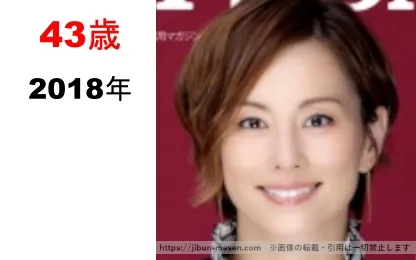 米倉涼子の整形疑惑検証2018年