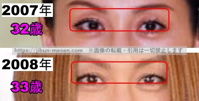 米倉涼子の目の整形検証2007年～2008年の画像（拡大）