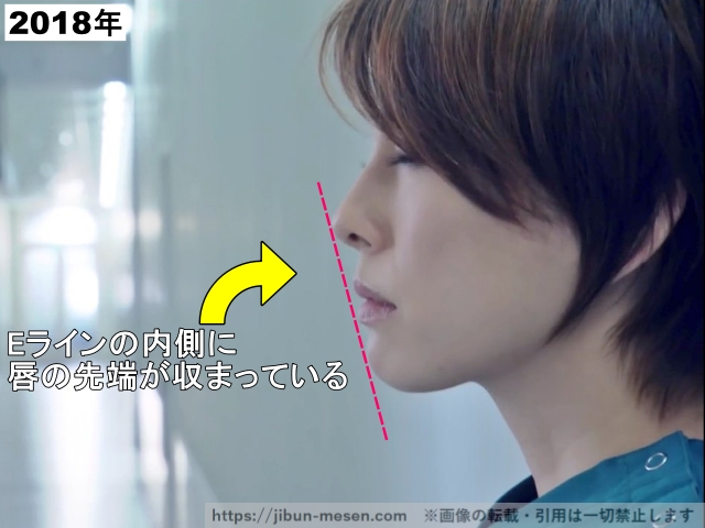 Eラインの内側に唇の先端が収まっている