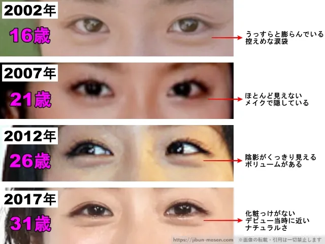 石原さとみの涙袋の整形検証2002年〜2017年