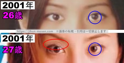 米倉涼子の目の整形検証2001年～2002年の画像(拡大)