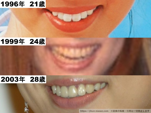 米倉涼子の歯並びの比較1996年〜2003年の画像