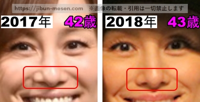 米倉涼子の鼻の整形検証2017年～2018年の画像（拡大）