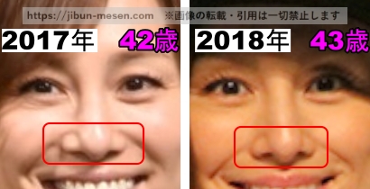 米倉涼子の鼻の整形検証2017年~2018年の画像(拡大)