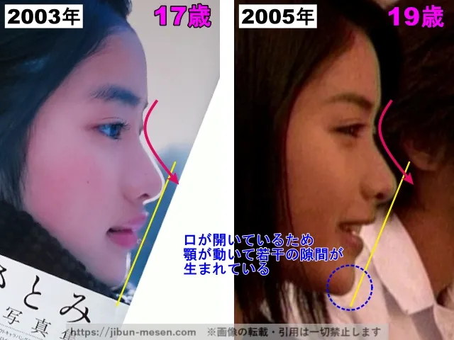 石原さとみの鼻の整形検証2003年〜2005年