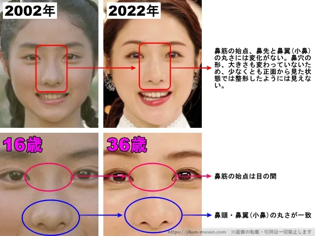 石原さとみの鼻の整形検証2002年〜2022年