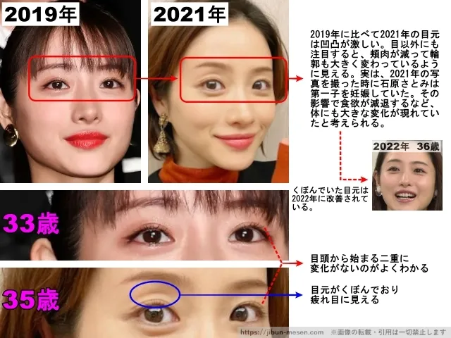 石原さとみの目の整形検証2019年〜2021年