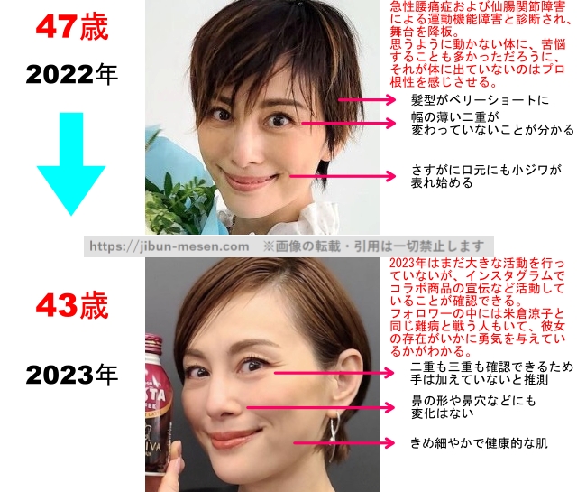 米倉涼子の整形疑惑検証2022年〜2023年の画像