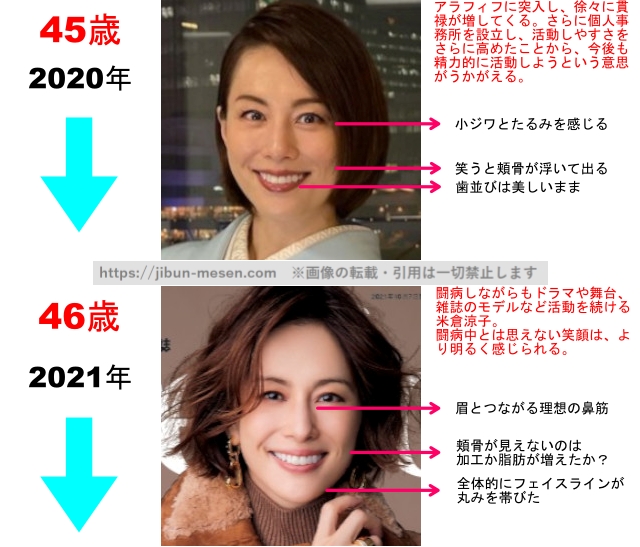 米倉涼子の整形疑惑検証2020年〜2021年の画像