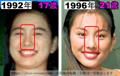 米倉涼子の鼻の整形検証1992年～1996年の画像