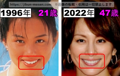 米倉涼子の口の整形検証1996年～2022年の画像