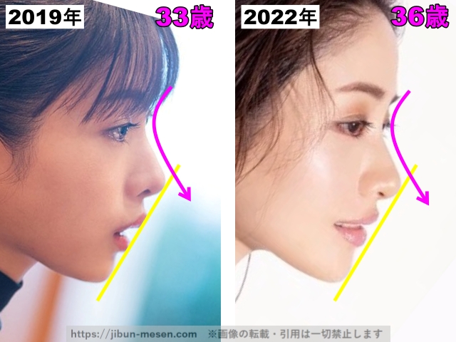 石原さとみの鼻の整形検証2019年〜2022年の画像