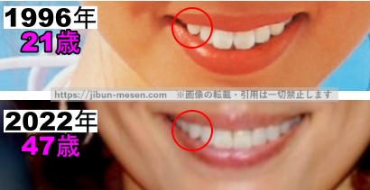 米倉涼子の口の整形検証1996年～2022年の画像（拡大）