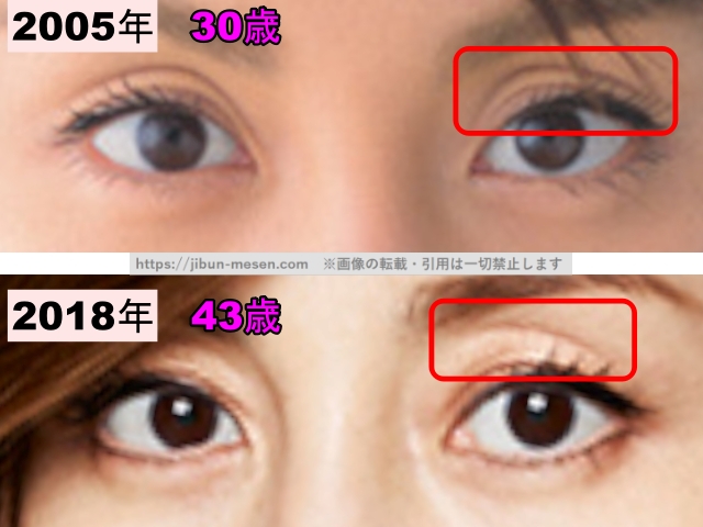 米倉涼子の目の整形検証2005年～2018年の画像