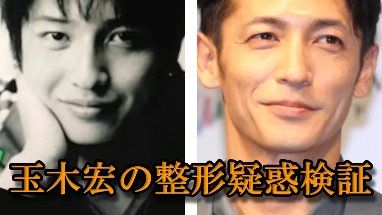 玉木宏の整形疑惑検証