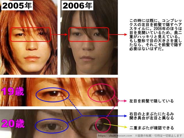 この時はすでに、コンプレックスの左目を前髪で隠すヘアスタイルに。2006年のほうは目を見開いているため、奥二重がハッキリと見えている。もし整形で目の大きさを直したなら、それこそ前髪で隠す必要はないはずだ。左目を前髪で隠している 右目の上まぶたにたるみ　開き具合が左目と異なる 二重まぶたが確認できる
