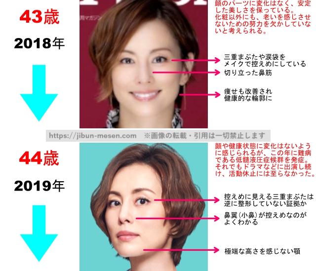 米倉涼子の整形疑惑検証2018年〜2019年の画像
