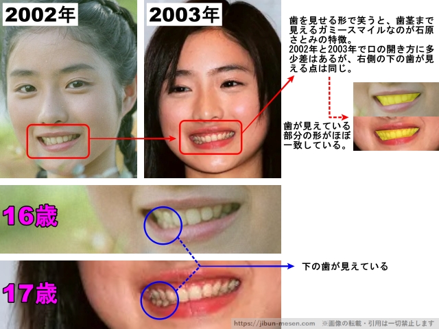 歯を見せる形で笑うと、歯茎まで見えるガミースマイルなのが石原さとみの特徴。2002年と2003年で口の開き方に多少差はあるが、右側の下の歯が見える点は同じ。歯が見えている部分の形がほぼ一致している。下の歯が見えている。