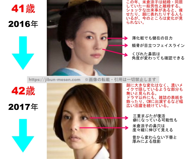 米倉涼子の整形疑惑検証2016年〜2017年の画像