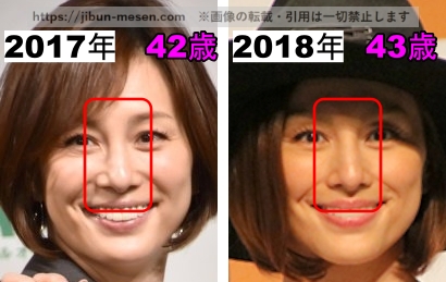 米倉涼子の鼻の整形検証2017年～2018年の画像