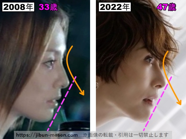 米倉涼子の鼻の整形検証2008年～2022年の画像