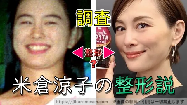 米倉涼子の整形説