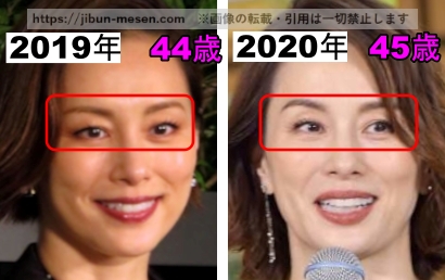 米倉涼子の目の整形検証2019年~2020年の画像