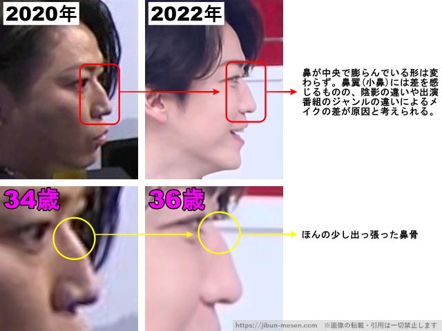 鼻が中央で膨らんでいる形は変わらず、鼻翼(小鼻)にはさを感じるものの、陰影の違いや出演番組のジャンルの違いによるメイクの差が原因と考えられる。ほんの少し出っ張った頬骨