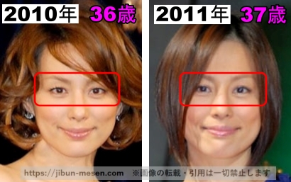 米倉涼子の目の整形検証2010年～2011年の画像