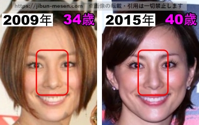 米倉涼子の鼻の整形検証2009年～2015年の画像
