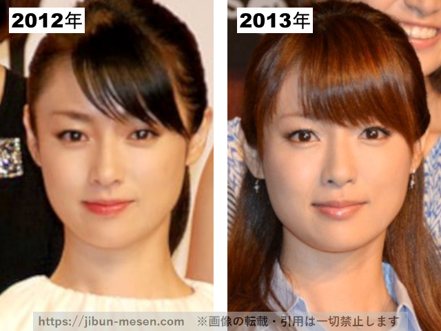 深田恭子の整形疑惑検証2012-2013の画像