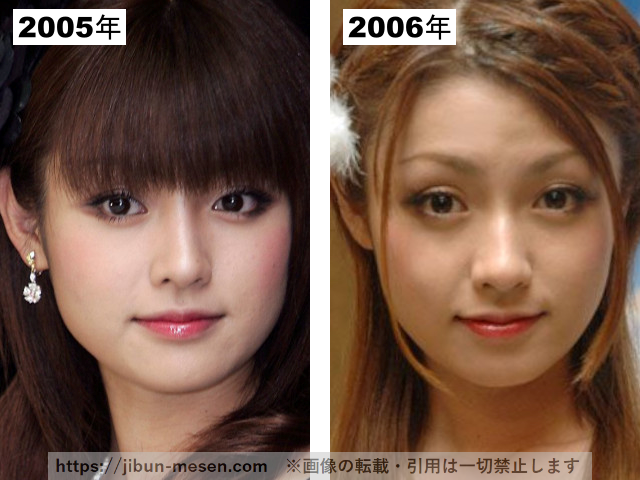 深田恭子の整形疑惑検証2005-2006の画像
