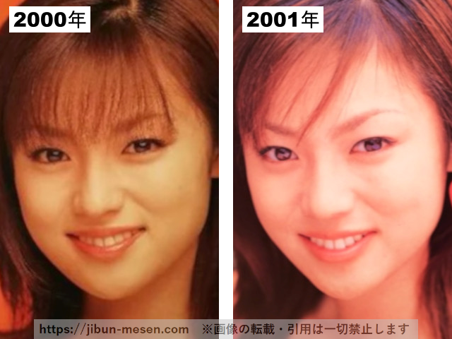 深田恭子の整形疑惑検証2000-2001の画像